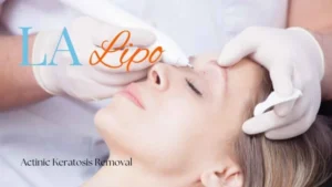 Woman receiving Actinic Keratosis Removal Treatment Portsmouth
