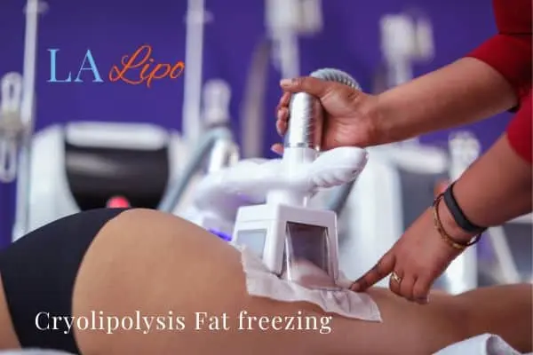 women getting fat freezing Portsmouth