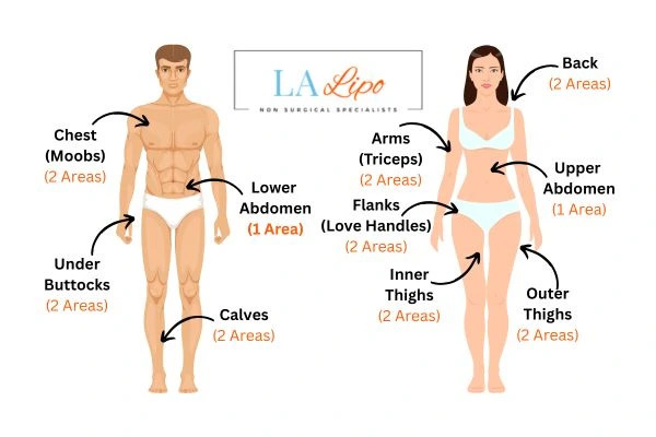 LA LIPO Cryolipolysis Areas Portsmouth