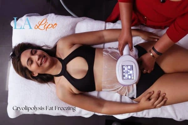 woman getting cryolipolysis Portsmouth