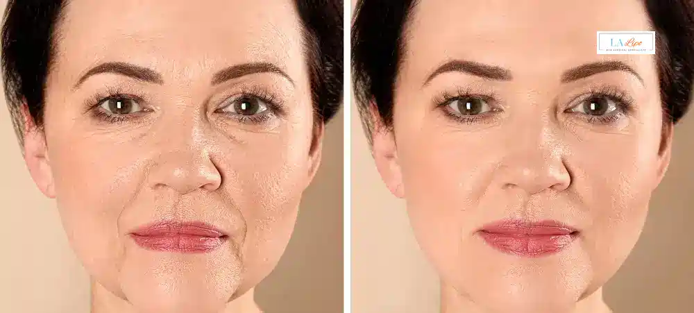 How Long Does It Take to See Results and How Long Do They Last Portsmouth?