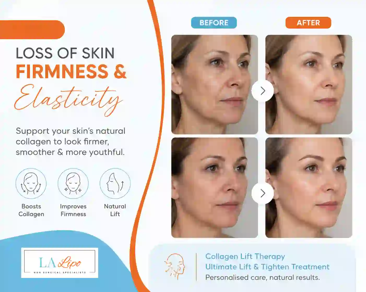 Sign #7: Loss of Skin Firmness and Elasticity Portsmouth